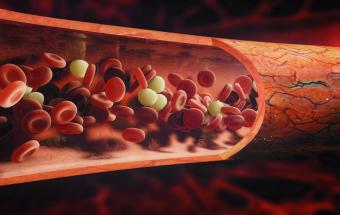 Descubren que el riesgo de sufrir leucemia se puede predecir años antes de ser diagnosticada