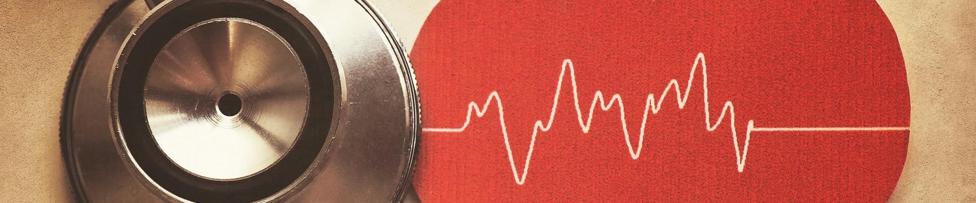 Principales pruebas diagnósticas del corazón