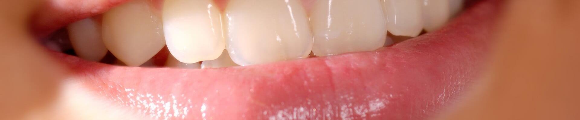 dientes